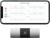 AliveCor KardiaMobile 6-Lead EKG Monitor – Instant Results