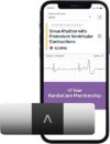 AliveCor KardiaMobile 6-Lead Personal EKG Monitor