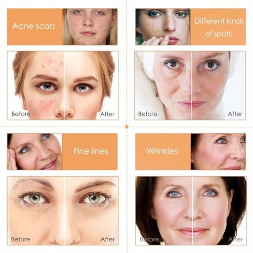 KASADA Vitamin C Skincare Set - Image 5