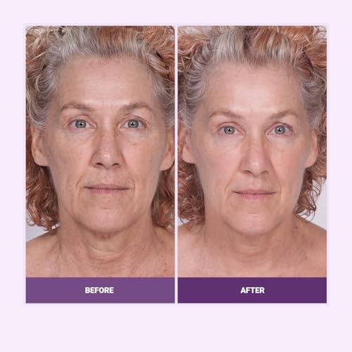 Serious Skincare Reverse Lift 4 Piece Set - Image 3