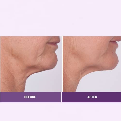 Serious Skincare Reverse Lift 4 Piece Set - Image 5