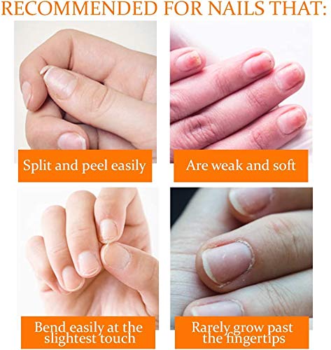 Nail Tek Repairs Damaged Nails kit - Image 4