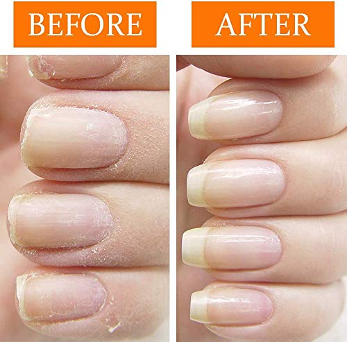 Nail Tek Repairs Damaged Nails kit - Image 5