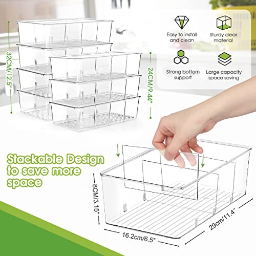 ZIZOTI 8 Pack Clear Storage Bins With Dividers - Image 2