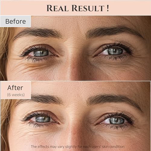 Beauty of Joseon Revive Eye Serum With Retinal Niacinamide - Image 3