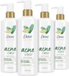 Dove Body Cleanser Acne Clear Body Wash