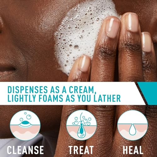 CeraVe Acne Foaming Cream Cleanser, 4% Benzoyl Peroxide - Image 3