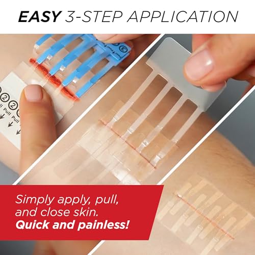 Clozex Emergency Laceration Closures - Repair Wounds - Image 5