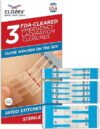 Clozex Emergency Laceration Closures – Repair Wounds