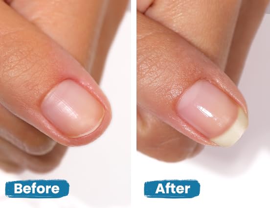 LONDONTOWN Nail Strengthener For Damaged Nails - Image 4